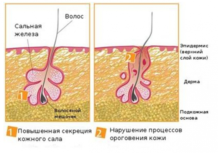 Почему протоки сальных желез впадают в волосяную. Сальная железасальня железа. Секреция сальных желез. Структура сальных желез.