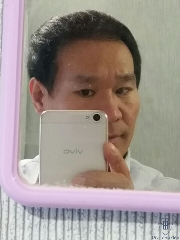 My default image