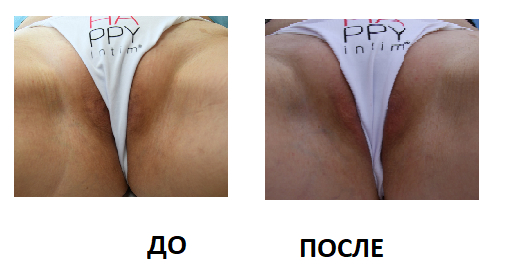 My default image