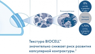 implanty-dlya-mammoplastiki-natrelle-kachestvennyj-produkt-dlya-nailuchshikh-rezultatov