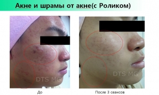 polipeptidy-protiv-stareniya-kozhi-za-schet-chego-effektivna-kosmetsevtika-genosys