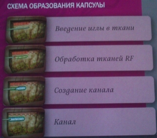 primenenie-rf-volny-konchike-igly-i-kanyuli