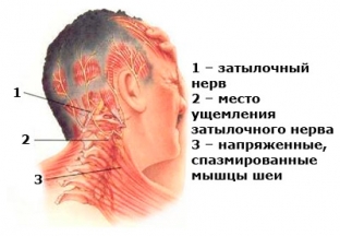simptomy-osteokhondroza-kotorye-prinimayut-za-drugie-nedugi