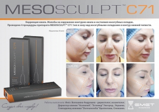 sozdaj-skulpturnye-cherty-korrektsiya-ovala-litsa-in-ektsionnymi-preparatami